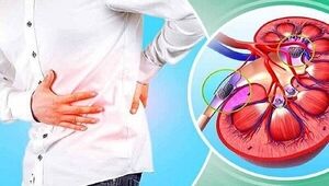 این نوشیدنی را برای فرار از سنگ کلیه نخورید! | ماءالشعیر دشمن سنگ کلیه است یا دوست آن؟