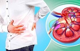 این نوشیدنی را برای فرار از سنگ کلیه نخورید! | ماءالشعیر دشمن سنگ کلیه است یا دوست آن؟