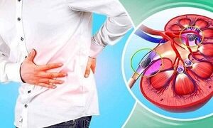 این نوشیدنی را برای فرار از سنگ کلیه نخورید! | ماءالشعیر دشمن سنگ کلیه است یا دوست آن؟